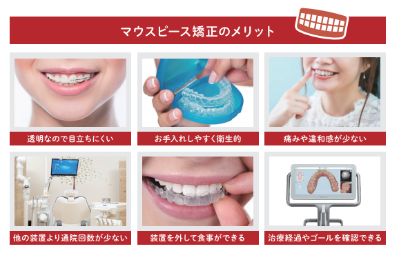 西新宿の新宿フロントタワー歯科では、マウスピース矯正による歯列治療を行っています。日常生活への負担を抑えつつ、安心して治療を進めていただけるよう、お一人おひとりのお口の状態に合わせた矯正プランをご提案しています。