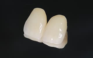 前歯で使用するセラミック