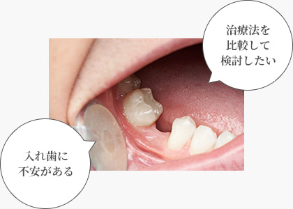 はじめて入れ歯を検討される方へ