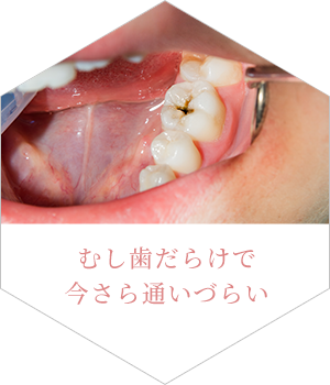 むし歯だらけで今さら通いづらい
