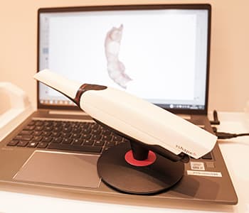 型取りの負担を軽減 口腔内スキャナ