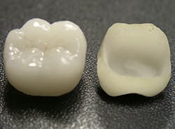 ジルコニア素材を使用しています