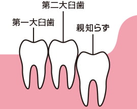 正常に生えているタイプ
