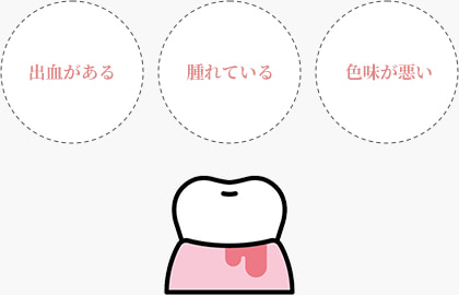 歯ぐき